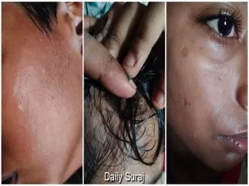 Bathinda Government School Student Allegedly Assaulted; Family Files Police Complaint